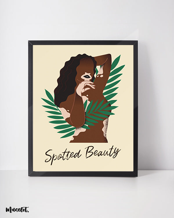 Spotted Beauty poster of a woman with vitiligo - Muselot
