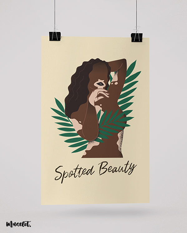 Spotted Beauty poster of a woman with vitiligo - Muselot